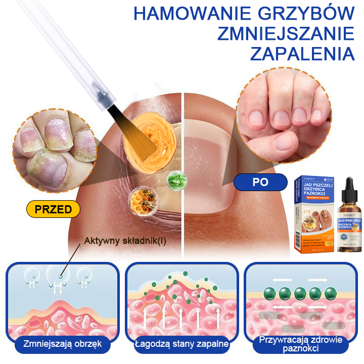 🐝👣Furzero™ Bienengift Nagelpilz Leczenie: Całkowite rozwiązanie problemu grzybicy paznokci🌟👣👣