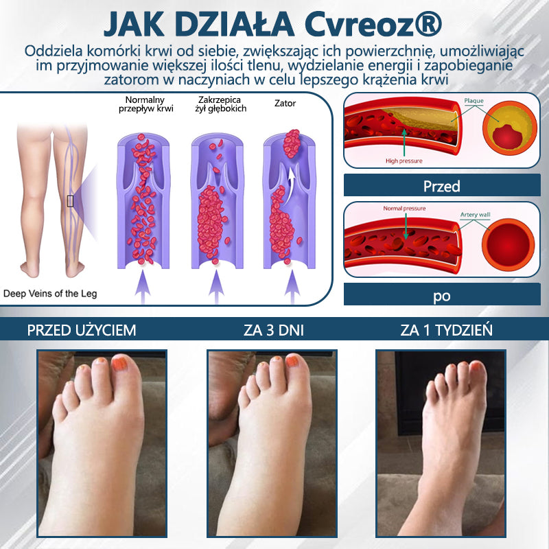 Detoksykujący krem ziołowy z czarnym kminkiem Cvreoz®🩹🩹
