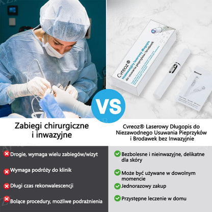 Cvreoz® nowy nieinwazyjny laser do usuwania pieprzyków i brodawek 🎉