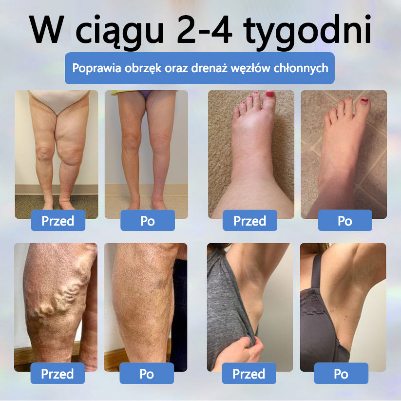 Detoksykujący krem ziołowy z czarnym kminkiem Cvreoz®🩹🩹