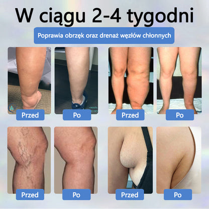 Detoksykujący krem ziołowy z czarnym kminkiem Cvreoz®🩹🩹