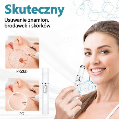 Cvreoz® nowy nieinwazyjny laser do usuwania pieprzyków i brodawek 🎉