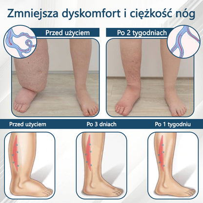 Detoksykujący krem ziołowy z czarnym kminkiem Cvreoz®🩹🩹