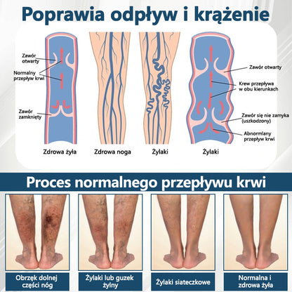 Detoksykujący krem ziołowy z czarnym kminkiem Cvreoz®🩹🩹