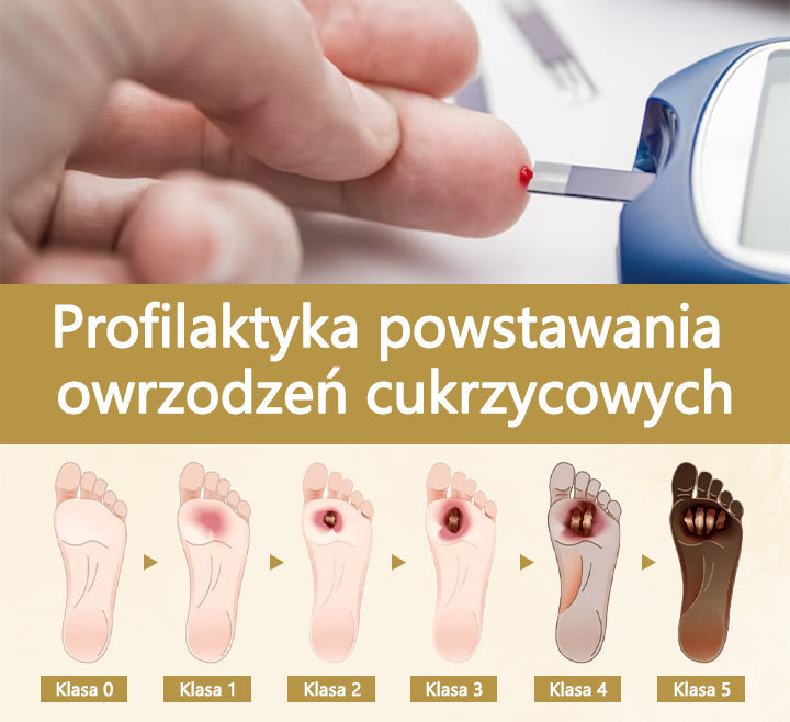 Cvreoz® Leczniczy spray do stóp cukrzycowych- zawiera jad pszczeli, który przyspiesza gojenie i zapobiega infekcjom!🌿🌿🌿