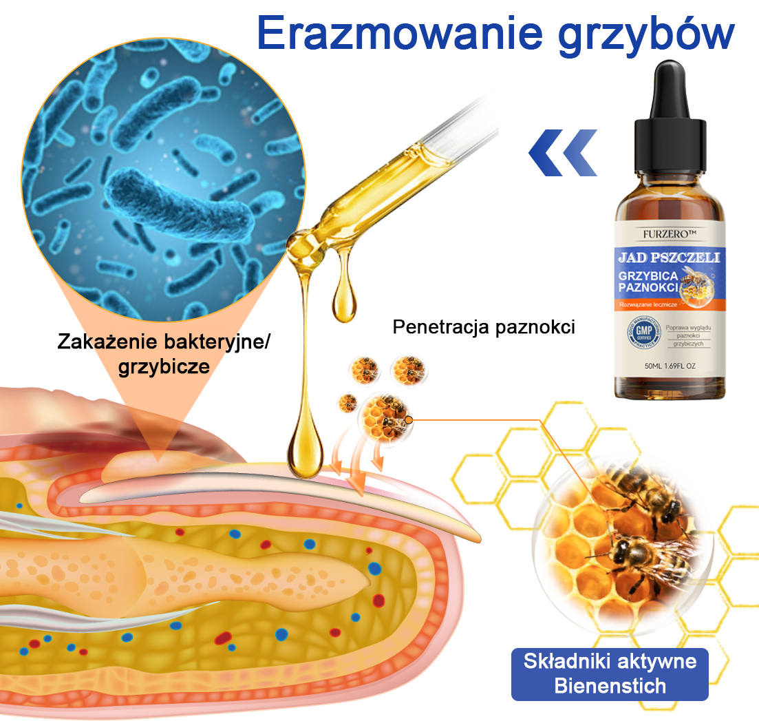 🐝👣Furzero™ Bienengift Nagelpilz Leczenie: Całkowite rozwiązanie problemu grzybicy paznokci🌟👣👣