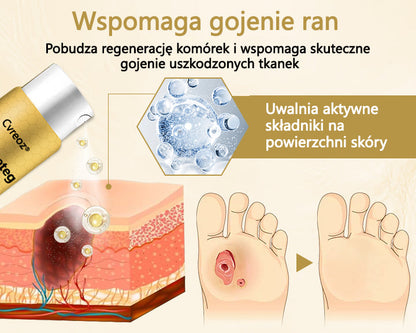 Cvreoz® Leczniczy spray do stóp cukrzycowych- zawiera jad pszczeli, który przyspiesza gojenie i zapobiega infekcjom!🌿🌿🌿