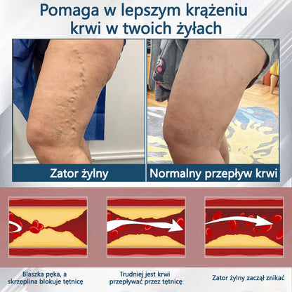 Detoksykujący krem ziołowy z czarnym kminkiem Cvreoz®🩹🩹